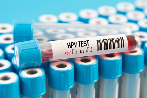 HPV virus lab test-drnashmilamjadipour.com-19